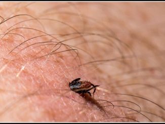 Bệnh Lyme là gì